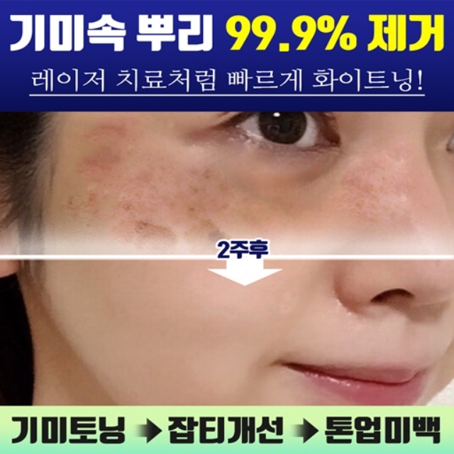 메이레브 화이트닝 집중케어 기미크림